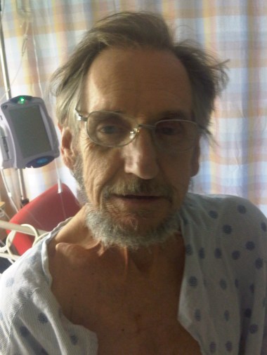 Tonys face Oct 8 2009