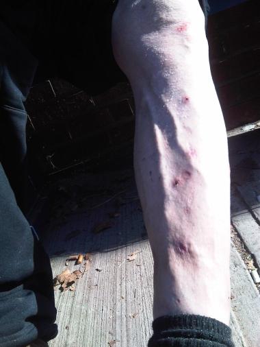 Welts on Tonys leg - Nov 12 2009